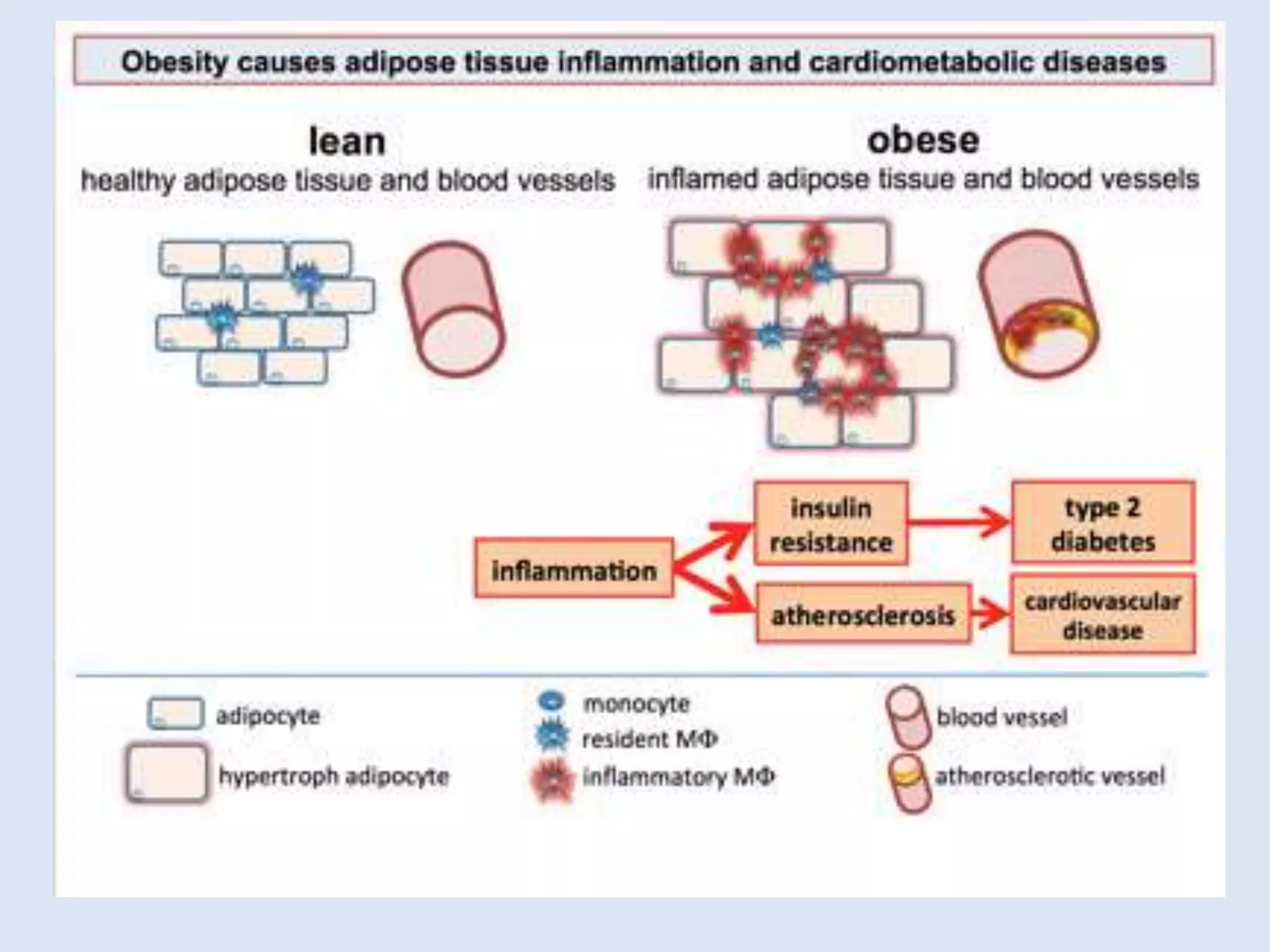 Obesity and Cardiovascular Disease | PPTX