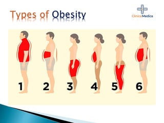 Image showcasing Obesity- EAT WISE DROP A SIZE (3).pptx