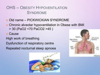 OHS – OBESITY HYPOVENTILATION
SYNDROME
 Old name – PICKWICKIAN SYNDROME
 Chronic alveolar hypoventilation in Obese with BMI
> 30 (PaO2 <70 PaCO2 >45 )
 Cause
High work of breathing
Dysfunction of respiratory centre
Repeated nocturnal sleep apnoea
 