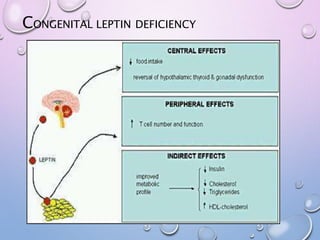 CONGENITAL LEPTIN DEFICIENCY
 