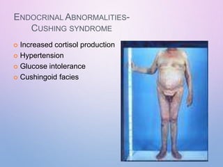 ENDOCRINAL ABNORMALITIES-
CUSHING SYNDROME
 Increased cortisol production
 Hypertension
 Glucose intolerance
 Cushingoid facies
 