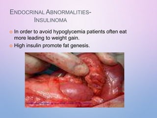 ENDOCRINAL ABNORMALITIES-
INSULINOMA
 In order to avoid hypoglycemia patients often eat
more leading to weight gain.
 High insulin promote fat genesis.
 