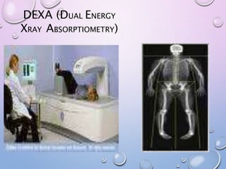 DEXA (DUAL ENERGY
XRAY ABSORPTIOMETRY)
 