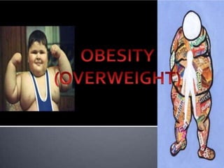 Obesity 2 Pptx