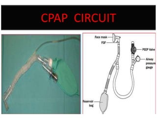 CPAP CIRCUIT

 