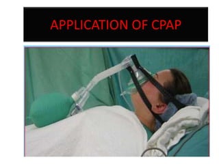 APPLICATION OF CPAP

 