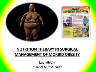NUTRITION THERAPY IN SURGICAL
MANAGEMENT OF MORBID OBESITY
Leo kihiuhi
Clinical Nutritionist
 