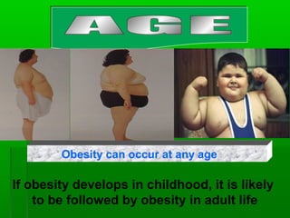 Obesity can occur at any age
If obesity develops in childhood, it is likely
to be followed by obesity in adult life
 