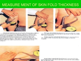MEASURE MENT OF SKIN FOLD THICKNESS
 