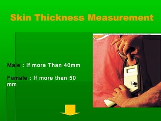 Skin Thickness Measurement
Male : If more Than 40mm
Female : If more than 50
mm
 