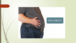 obesity and its prevention.pptx community medicine. | PPTX