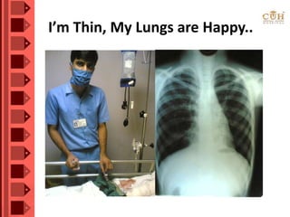 I’m Thin, My Lungs are Happy..
 