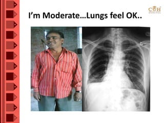 I’m Moderate…Lungs feel OK..
 