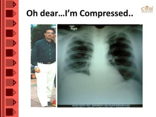 Oh dear…I’m Compressed..
 