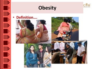 • Definition….
Obesity
 