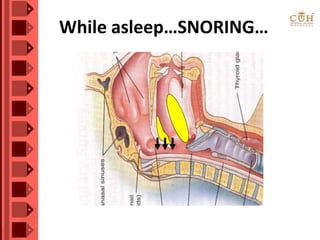 While asleep…SNORING…
 