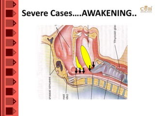 Severe Cases….AWAKENING..
 