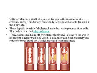 Obesity & Coronary Heart Diseases.ppt
