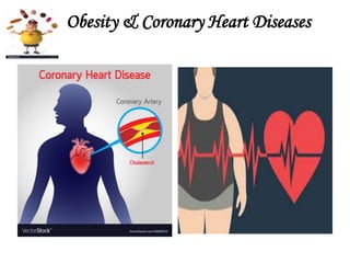 Obesity & Coronary Heart Diseases
 