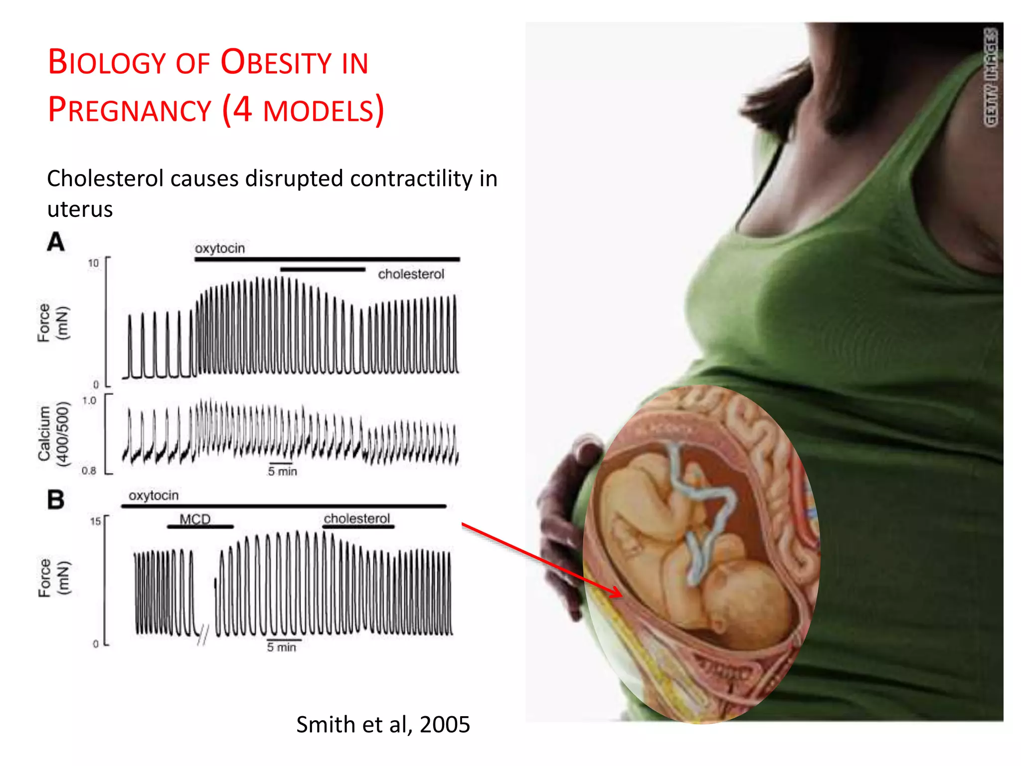Obesity in Pregnancy | PPTX