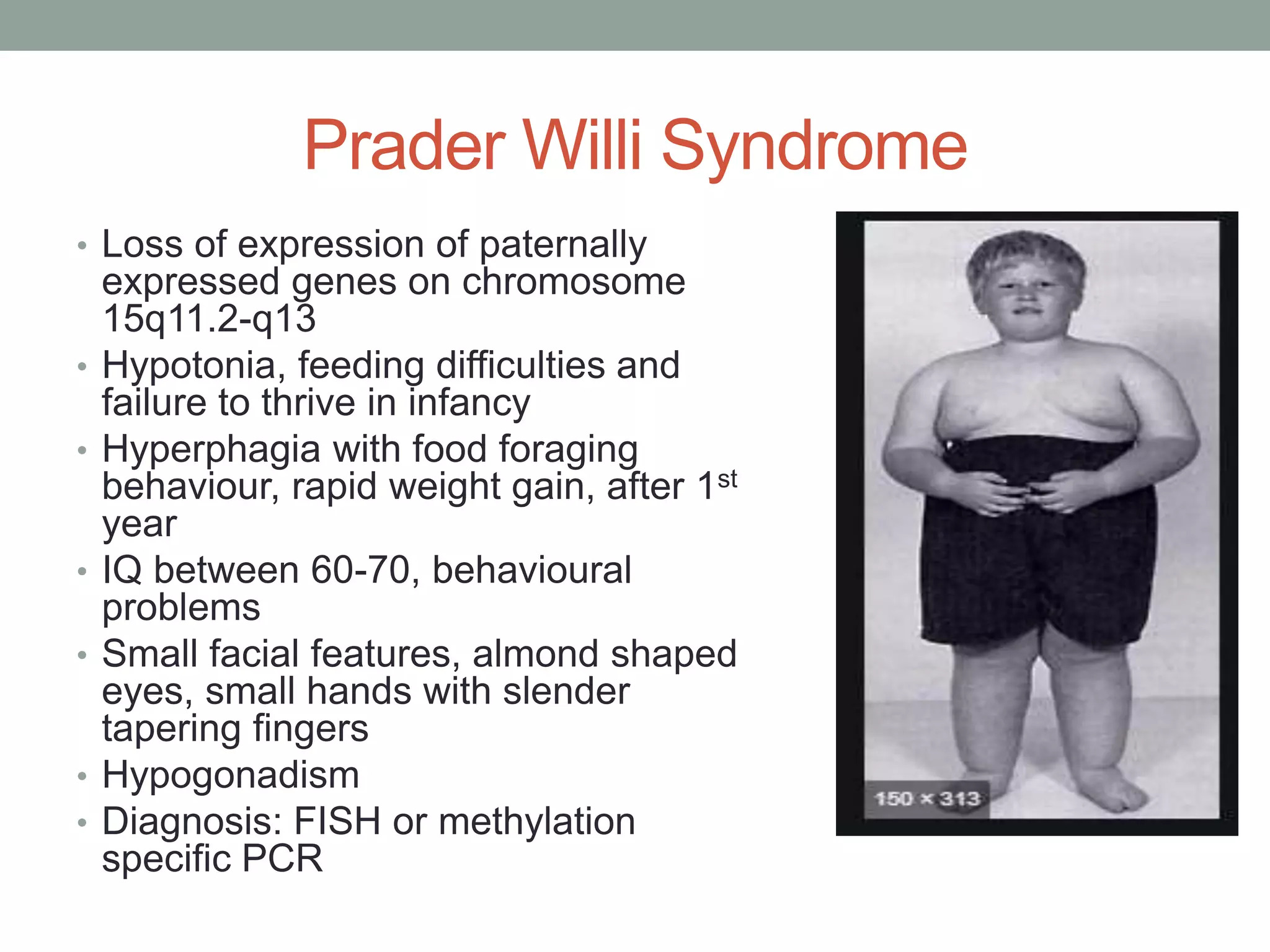Image showcasing Obesity in children | PPTX