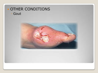    OTHER CONDITIONS
    ◦ Gout
 