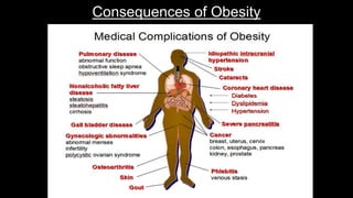 Consequences of Obesity
 