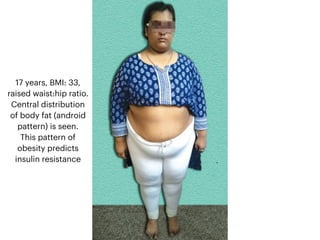 Obesity in OBGYN.pdf