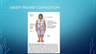 OBESITY – PATHOPHYSIOLOGY AND MANAGEMENT.pptx