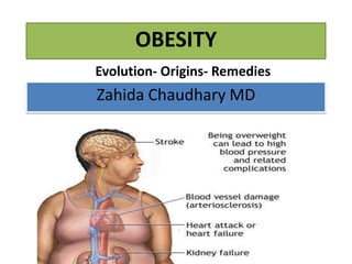 OBESITY
Evolution- Origins- Remedies

Zahida Chaudhary MD

 