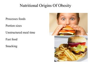 Nutritional Origins Of Obesity
Processes foods

Portion sizes
Unstructured meal time
Fast food
Snacking

 
