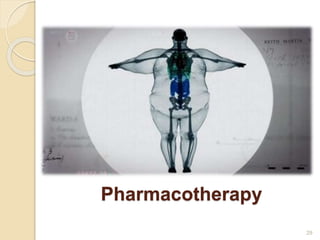 Pharmacotherapy
29
 