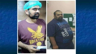 Obesity & Renal Failure