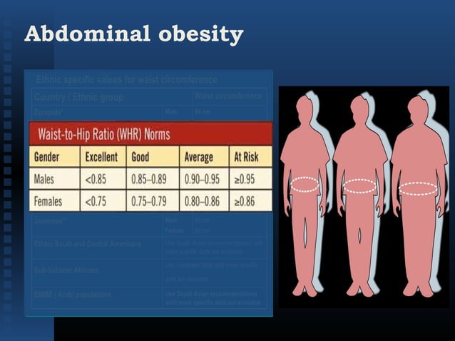 Obesity, prevalence, risk factors, approach to management- Dr Shahjada ...