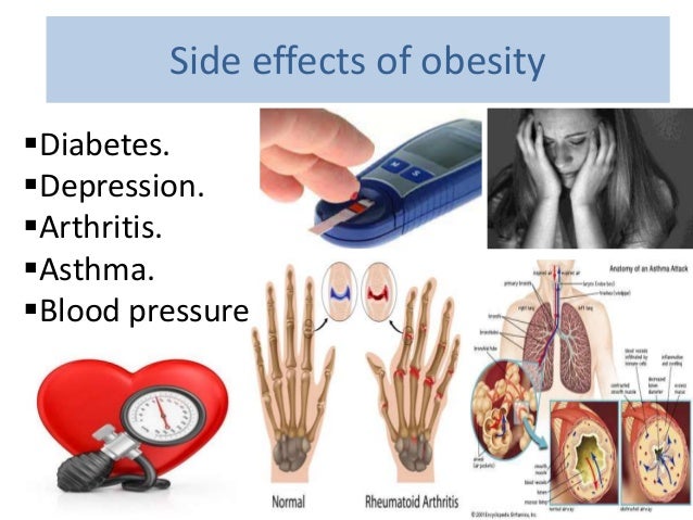 Obesity Self Control