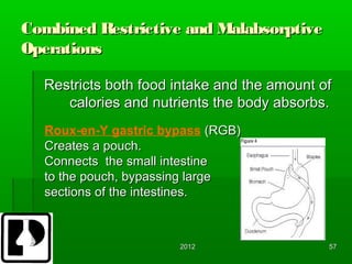Combined Restrictive and Malabsorptive
Operations

  Restricts both food intake and the amount of
     calories and nutrients the body absorbs.
  Roux-en-Y gastric bypass (RGB)
  Creates a pouch.
  Connects the small intestine
  to the pouch, bypassing large
  sections of the intestines.



                      2012                   57
 