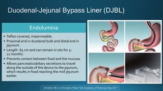 Endolumin Endoscopic and surgical treatment of obesity | PPTX