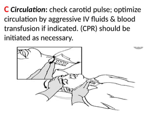 .
C Circulation: check carotid pulse; optimize
circulation by aggressive IV fluids & blood
transfusion if indicated. (CPR) should be
initiated as necessary.
 