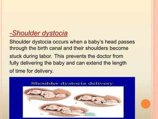 -Shoulder dystocia
Shoulder dystocia occurs when a baby’s head passes
through the birth canal and their shoulders become
stuck during labor. This prevents the doctor from
fully delivering the baby and can extend the length
of time for delivery.
 