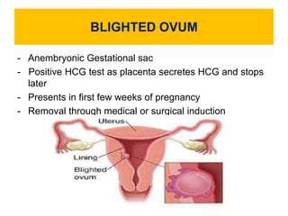 BLIGHTED OVUM
- Anembryonic Gestational sac
- Positive HCG test as placenta secretes HCG and stops
later
- Presents in first few weeks of pregnancy
- Removal through medical or surgical induction
 