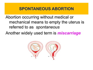 SPONTANEOUS ABORTION
Abortion occurring without medical or
mechanical means to empty the uterus is
referred to as spontaneous
Another widely used term is miscarriage
 