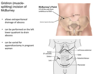 Gridiron (muscle-
splitting) incision of
McBurney
• allows extraperitoneal
drainage of abscess
• can be performed on the left
lower quadrant to drain
abscess
• can be varied for
appendicectomy in pregnant
women
 