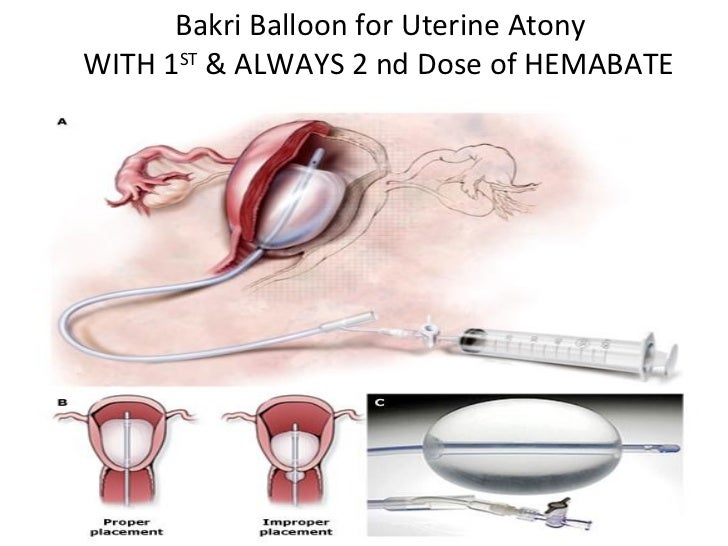 Ob hemorrhage