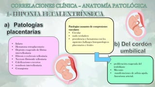 • Infarto
• Hematoma retroplacentario
• Depósito exagerado de fibrina
intervellositaria
• Fibrosis o esclerosis vellositaria
• Necrosis fibrinoide vellositaria
• Calcificaciones excesivas
• trombosis intervellositaria
• Corangioma
Patologías causantes de compresiones
vasculares
• Circular
• nudo verdadero
• procidencia o hematoma con los
siguientes hallazgos histopatológicos
placentarios y fetales
• proliferación exagerada del
trofoblasto
• Meconio
• manifestaciones de asfixia aguda.
Aneurisma arterial.
 