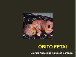 ÓBITO FETAL
Brenda Angelique Figueroa Sarango
 
