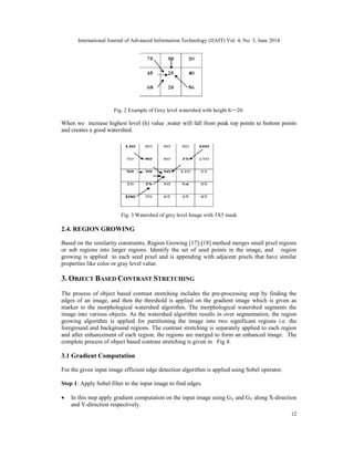 International Journal of Advanced Information Technology (IJAIT) Vol. 4, No. 3, June 2014
12
Fig. 2 Example of Grey level watershed with height h>=20.
When we increase highest level (h) value ,water will fall from peak top points to bottom points
and creates a good watershed.
Fig. 3 Watershed of grey level Image with 5X5 mask
2.4. REGION GROWING
Based on the similarity constraints, Region Growing [17]-[18] method merges small pixel regions
or sub regions into larger regions. Identify the set of seed points in the image, and region
growing is applied to each seed pixel and is appending with adjacent pixels that have similar
properties like color or gray level value.
3. OBJECT BASED CONTRAST STRETCHING
The process of object based contrast stretching includes the pre-processing step by finding the
edges of an image, and then the threshold is applied on the gradient image which is given as
marker to the morphological watershed algorithm. The morphological watershed segments the
image into various objects. As the watershed algorithm results in over segmentation, the region
growing algorithm is applied for partitioning the image into two significant regions i.e. the
foreground and background regions. The contrast stretching is separately applied to each region
and after enhancement of each region, the regions are merged to form an enhanced image. The
complete process of object based contrast stretching is given in Fig 4.
3.1 Gradient Computation
For the given input image efficient edge detection algorithm is applied using Sobel operator.
Step 1: Apply Sobel filter to the input image to find edges.
• In this step apply gradient computation on the input image using GX and GY along X-direction
and Y-direction respectively.
 