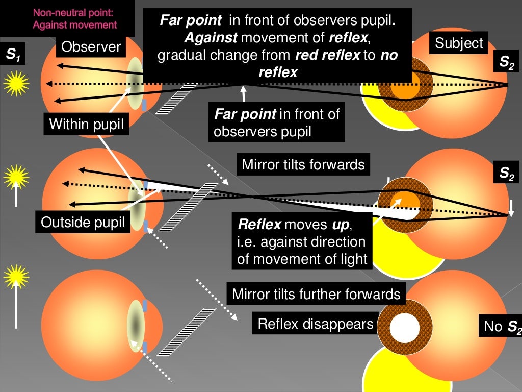 Objective refraction