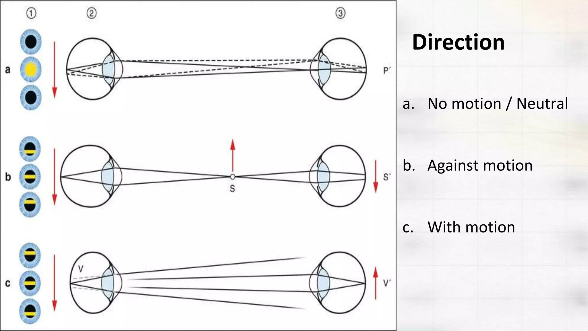 Objective Retinoscopy Objective retinoscopy | PPTX