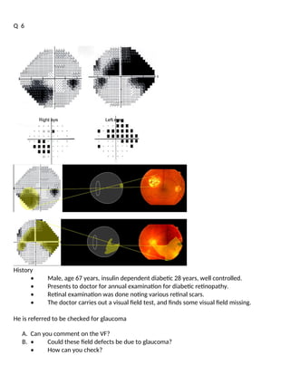 Visual Neglect Test Osce Objective Structured Clinical Examination (OSCE) Ophthalmology ...
