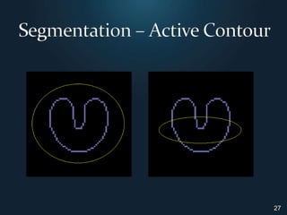 27Segmentation – Active Contour